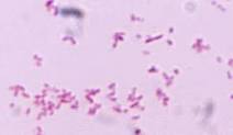 Gram negative rodsOropharyngeal floramay be pathogens those possessing capsules can be stareotyped but most normal flora non encapsulated 